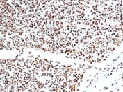 IHC staining of FFPE human lymph node tissue with Ku80 antibody (clone XRCC5/7317). HIER: boil tissue sections in pH 9 10mM Tris with 1mM EDTA for 20 min and allow to cool before testing.