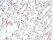 IHC staining of FFPE human kidney tissue with Ku80 antibody (clone XRCC5/7317). HIER: boil tissue sections in pH 9 10mM Tris with 1mM EDTA for 20 min and allow to cool before testing.