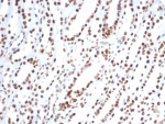 IHC staining of FFPE human kidney tissue with XRCC5 antibody (clone XRCC5/7318). HIER: boil tissue sections in pH 9 10mM Tris with 1mM EDTA for 20 min and allow to cool before testing.