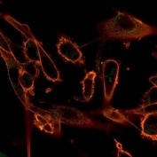 Immunofluorescent staining of PFA-fixed human human U-87 cells using CBF beta antibody (green, clone PCRP-CBFB-1E6) and phalloidin (red).