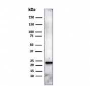Western blot testing of human HeLa cell lysate using CBF beta antibody (clone PCRP-CBFB-1E6). Predicted molecular weight ~22 kDa.