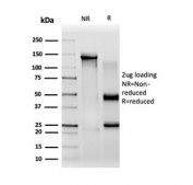 SDS-PAGE analysis of purified, BSA-free CBF beta antibody (clone PCRP-CBFB-1E6) as confirmation of integrity and purity.