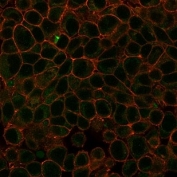 Immunofluorescent staining of PFA-fixed human HeLa cells using HDAC3 antibody (green, clone PCRP-HDAC3-3C9) and phalloidin (red).