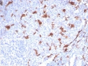 IHC staining of FFPE human tonsil tissue with LPLUNC1 antibody (clone LPLUNC1/7059R). Negative control inset: PBS used instead of primary antibody to control for secondary Ab binding. HIER: boil tissue sections in pH 9 10mM Tris with 1mM EDTA for 20 min and allow to cool before testing.