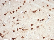 IHC staining of FFPE human brain tissue with LPLUNC1 antibody (clone LPLUNC1/7059R). HIER: boil tissue sections in pH 9 10mM Tris with 1mM EDTA for 20 min and allow to cool before testing.
