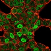 Immunofluorescent staining of PFA-fixed human MCF7 cells using QKI antibody (green, clone PCRP-QKI-2F10) and phalloidin (red).