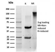 SDS-PAGE analysis of purified, BSA-free QKI antibody (clone PCRP-QKI-2F10) as confirmation of integrity and purity.