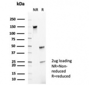 SDS-PAGE analysis of purified, BSA-free CD35 antibody (clone CR1/6385) as confirmation of integrity and purity.