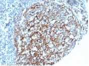 IHC staining of FFPE human spleen tissue with CD35 antibody (clone CR1/6385) at 2ug/ml. HIER: boil tissue sections in pH 9 10mM Tris with 1mM EDTA for 20 min and allow to cool before testing.