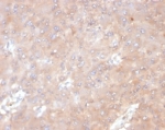 IHC staining of FFPE human tonsil tissue with IL-6 antibody (clone IL6/4641) at 2ug/ml. HIER: boil tissue sections in pH 9 10mM Tris with 1mM EDTA for 20 min and allow to cool before testing.