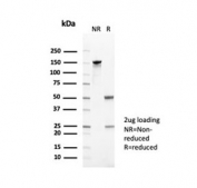 SDS-PAGE analysis of purified, BSA-free CD35 antibody (clone CR1/6378) as confirmation of integrity and purity.