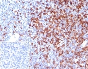 IHC staining of FFPE human tonsil tissue with CD4 antibody (clone CD4/7142). Negative control inset: PBS instead of primary antibody to control for secondary binding. HIER: boil tissue sections in pH 9 10mM Tris with 1mM EDTA for 20 min and allow to cool before testing.