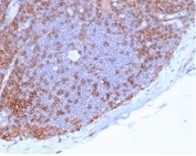 IHC staining of FFPE human lymph node tissue with CD4 antibody (clone CD4/7144) at 2ug/ml in PBS for 30min RT. HIER: boil tissue sections in pH 9 10mM Tris with 1mM EDTA for 20 min and allow to cool before testing.