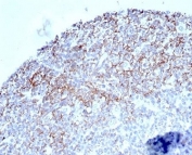 IHC staining of FFPE human tonsil tissue with CD35 antibody (clone CR1/6377) at 2ug/ml. HIER: boil tissue sections in pH 9 10mM Tris with 1mM EDTA for 20 min and allow to cool before testing. HIER: boil tissue sections in pH 9 10mM Tris with 1mM EDTA for 20 min and allow to cool before testing.