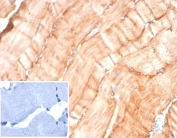 IHC staining of FFPE human skeletal muscle tissue with Desmin antibody (clone DES/4526) at 2ug/ml. Negative control inset: PBS instead of primary antibody to control for secondary binding. HIER: boil tissue sections in pH 9 10mM Tris with 1mM EDTA for 20 min and allow to cool before testing.
