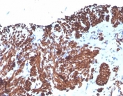 IHC staining of FFPE human uterus with Desmin antibody (clone DES/4526). HIER: boil tissue sections in pH 9 10mM Tris with 1mM EDTA for 20 min and allow to cool before testing.