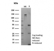 SDS-PAGE analysis of purified, BSA-free recombinant Aldose reductase 1B1 antibody (clone rAKR1B1/7296) as confirmation of integrity and purity.