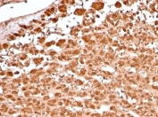 IHC staining of FFPE human adrenal gland tissue with Aldose Reductase 1B1 antibody (clone rAKR1B1/7296). HIER: boil tissue sections in pH 9 10mM Tris with 1mM EDTA for 20 min and allow to cool before testing.