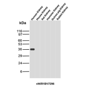 Recombinant Aldose Reductase Antibody Cross-Species WB. Western blot analysis of kidney tissue lysates from multiple species using recombinant Aldose reductase 1B1 Antibody clone rAKR1B1/7296. A distinct band is detected near approximately 35-40 kDa in human kidney tissue, consistent with the predicted molecular weight of Aldose reductase / AKR1B1, an aldo-keto reductase family enzyme involved in polyol pathway metabolism, oxidative stress regulation, and glucose-responsive cellular signaling pathways. Minimal signal is observed in the additional species tested under these experimental conditions.