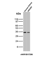 Recombinant Aldose Reductase Antibody Kidney and HEK293T WB. Western blot analysis of human kidney tissue and HEK293T cell lysates using recombinant Aldose reductase 1B1 Antibody clone rAKR1B1/7296. Strong bands are detected near approximately 35-40 kDa in both samples, consistent with the predicted molecular weight of Aldose reductase / AKR1B1, an aldo-keto reductase family enzyme involved in polyol pathway metabolism, oxidative stress regulation, and glucose-responsive cellular signaling pathways.