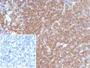 IHC staining of FFPE human tonsil tissue with recombinant CD45RA antibody (clone rPTPRC/7284). Negative control inset: PBS instead of primary antibody to control for secondary binding. HIER: boil tissue sections in pH 9 10mM Tris with 1mM EDTA for 20 min and allow to cool before testing.