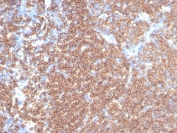 IHC staining of FFPE human tonsil tissue with recombinant CD45RA antibody (clone rPTPRC/7284). HIER: boil tissue sections in pH 9 10mM Tris with 1mM EDTA for 20 min and allow to cool before testing.