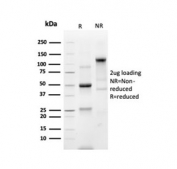 SDS-PAGE analysis of purified, BSA-free recombinant Prostein antibody (clone SLC45A3/7176R) as confirmation of integrity and purity.