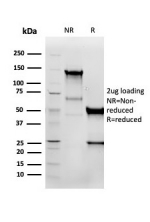 Western blot testing of human U-87 MG cell lysate using recombinant Vimentin antibody (clone VIM/6576R). Predicted molecular weight ~53 kDa.