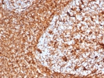IHC staining of FFPE human tonsil tissue with recombinant Vimentin antibody (clone VIM/6576R). HIER: boil tissue sections in pH 9 10mM Tris with 1mM EDTA for 20 min and allow to cool before testing.