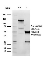 SDS-PAGE analysis of purified, BSA-free recombinant Vimentin antibody (clone VIM/6576R) as confirmation of integrity and purity.