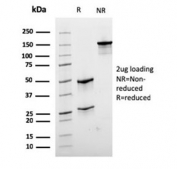 SDS-PAGE Analysis of Purified, BSA-Free recombinant Desmin Antibody (clone rDES/1711). Confirmation of Integrity and Purity of the Antibody.