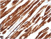 IHC testing of FFPE human uterus with recombinant Desmin antibody (clone rDES/1711). Required HIER: boil tissue sections in 10mM citrate buffer, pH 6, for 10-20 min.