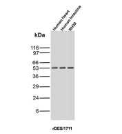 Desmin Antibody Human Tissue Panel WB. Western blot analysis of human heart, human intestine, and RH30 cell lysates using Desmin Antibody (clone rDES/1711) detects a band at approximately 53 kDa, consistent with the expected molecular weight of Desmin. The presence of signal in heart and intestine tissues, as well as rhabdomyosarcoma cells, supports detection of this muscle-associated intermediate filament protein, aligning with its role in muscle structure and differentiation.