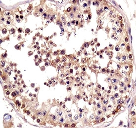 TSPY antibody immunohistochemistry analysis in formalin fixed and paraffin embedded human testis tissue.