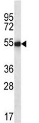Ihh antibody western blot analysis in mouse liver tissue lysate