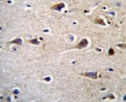 CRFR2D antibody immunohistochemistry analysis in formalin fixed and paraffin embedded human brain tissue.