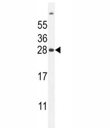 FAT10 Antibody Mouse Liver WB. Western blot analysis of FAT10 expression was performed using anti-FAT10 antibody in mouse liver tissue lysate. FAT10, also known as Ubiquitin D (UBD), is a ubiquitin-like modifier that targets proteins for proteasomal degradation and plays important roles in immune regulation, inflammatory signaling, and protein homeostasis. A specific immunoreactive band is detected at approximately 28 kDa, consistent with the observed migration of FAT10 under these experimental conditions. Differences between predicted and apparent molecular weight may reflect the biochemical properties of this ubiquitin-like protein or post-translational modification. These results support the utility of FAT10 Antibody for studies of proteasomal degradation, ubiquitin-like protein conjugation, immune responses, and inflammation.