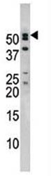 Western blot analysis of anti-NUP50 antibody and mouse brain tissue lysate