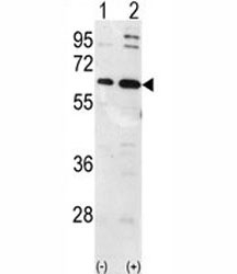 Western blot analysis of Ubiquilin-1 antibody and 293 cell lysate (2 ug/lane) either nontransfected (Lane 1) or transiently transfected with the Ubiquilin1 gene (2).