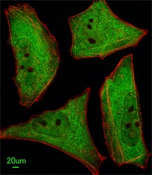 Immunofluorescent analysis of HeLa cells using Ubiquilin1 antibody; Ab was diluted at 1:100 dilution. Alexa Fluor 488-conjugated goat anti-rabbit lgG was used as the secondary Ab (green). Cytoplasmic actin was counterstained with Dylight Fluor 554 (red) conjugated Phalloidin (red).