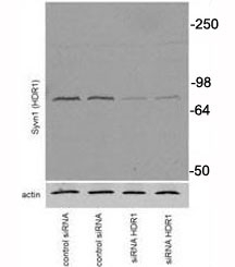 Western blot testing of SYVN1 antibody and transiently transfected Neuro2A cells. Predicted molecular weight: ~68kDa.