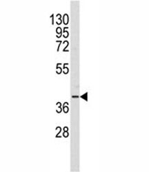 Western blot analysis of AKR1A1 antibody and Y79 lysate. Predicted molecular weight: ~37kDa.