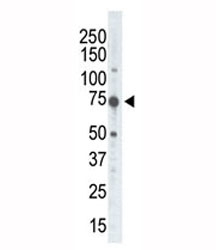 Western blot of RSKB antibody and placenta tissue lysate