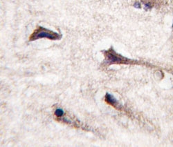 IHC analysis of FFPE human brain tissue stained with PKC beta 2 antibody