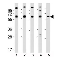 Western blot testing of Pyruvate Kinase antibody at 1:2000 dilution. Lane 1: MCF-7 lysate; 2: HeLa; 3: THP-1; 4: NIH3T3; 5: PC-12; Predicted molecular weight ~ 58 kDa.