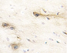 IHC analysis of FFPE human brain tissue stained with MARK1 antibody