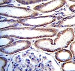 MUC20 antibody immunohistochemistry analysis in formalin fixed and paraffin embedded human kidney tissue.
