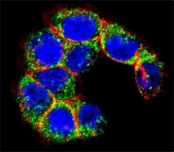 Confocal immunofluorescent analysis of MUC20 antibody with WiDr cells followed by Alexa Fluor 488-conjugated goat anti-rabbit lgG (green). Actin filaments have been labeled with Alexa Fluor 555 Phalloidin (red). DAPI was used as a nuclear counterstain (blue).