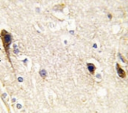 IHC analysis of FFPE human brain tissue stained with PIP5K1B antibody