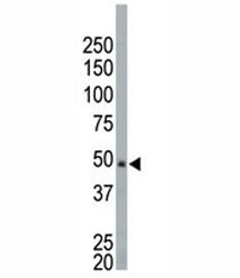NEK2 antibody used in western blot to detect NEK2 in HeLa cell lysate